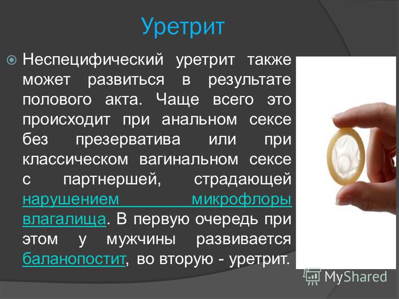 А вы при анальном сексе обкакаться не боитесь?