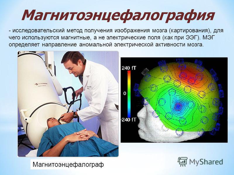 Магнитоэнцефалограф Магнитоэнцефалография - исследовательский метод получения изображения мозга (картирования), для чего используются магнитные, а не электрические поля (как при ЭЭГ). МЭГ определяет направление аномальной электрической активности моз