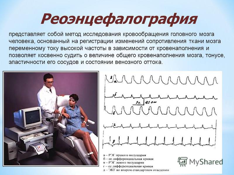 Реоэнцефалография представляет собой метод исследования кровообращения головного мозга человека, основанный на регистрации изменений сопротивления ткани мозга переменному току высокой частоты в зависимости от кровенаполнения и позволяет косвенно суди