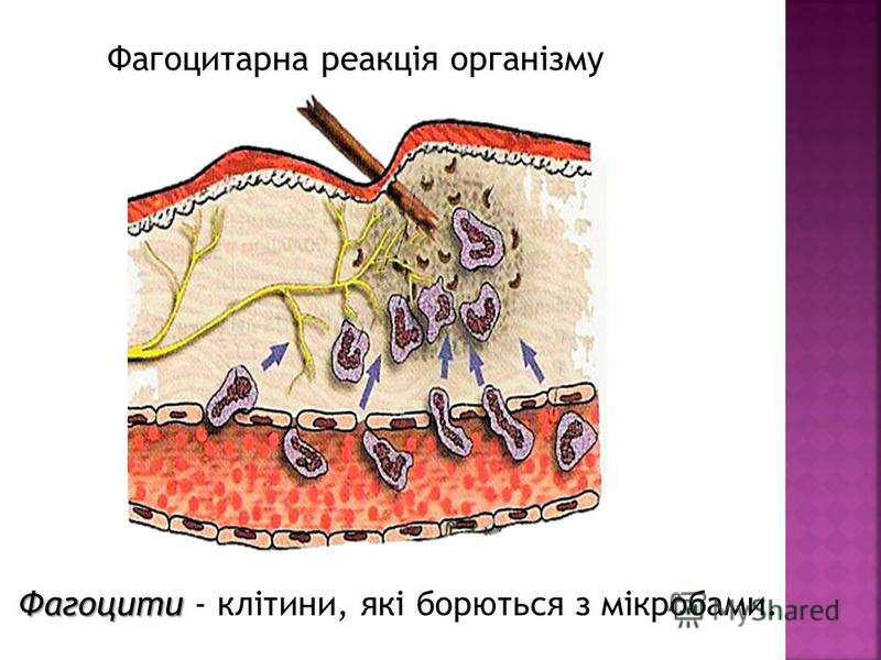 Фагоцитарна реакція організму Фагоцити Фагоцити - клітини, які борються з мікробами.