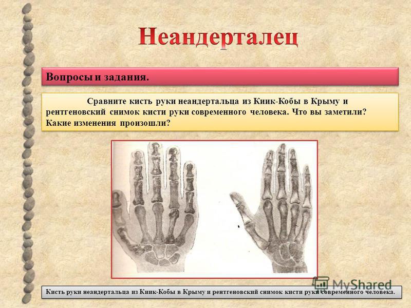Вопросы и задания. Сравните кисть руки неандертальца из Киик-Кобы в Крыму и рентгеновский снимок кисти руки современного человека. Что вы заметили? Какие изменения произошли? Кисть руки неандертальца из Киик-Кобы в Крыму и рентгеновский снимок кисти 