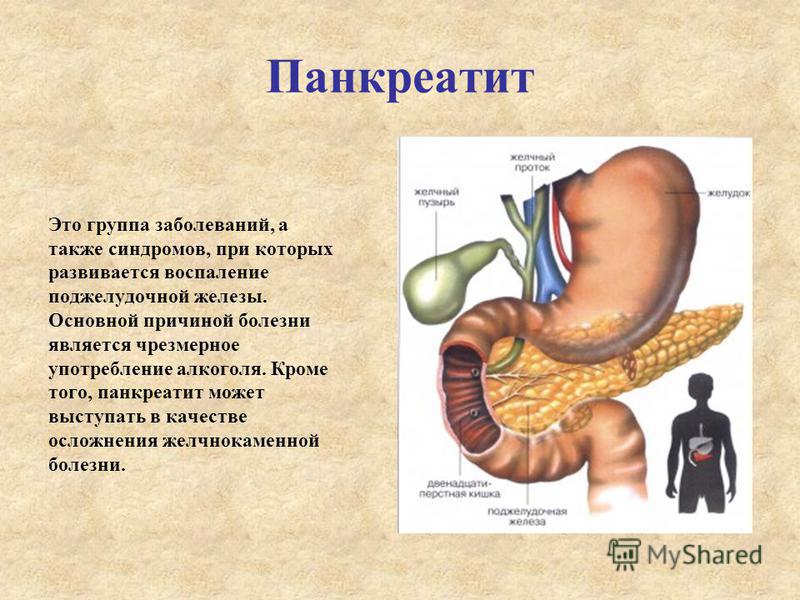 Болезни пищеварения и с чем они связаны Болезни пищеварения и с чем они связаны