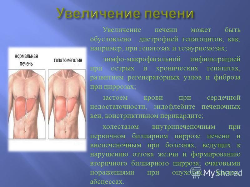 печеночный запах изо рта печеночный запах изо рта