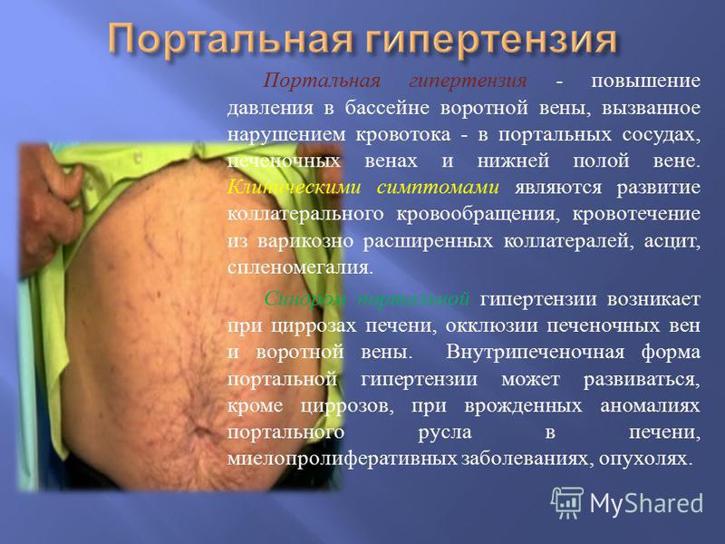 печеночный запах изо рта печеночный запах изо рта