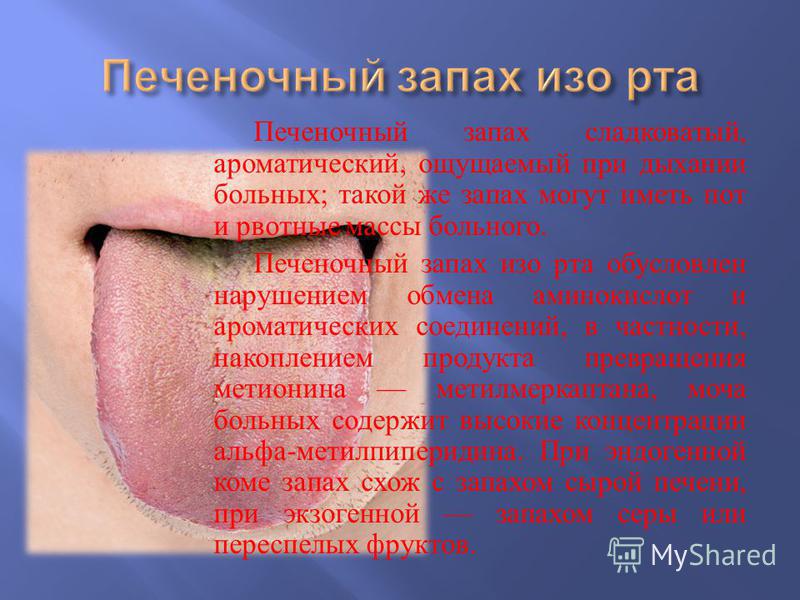 Вирусный гепатит в. этиология