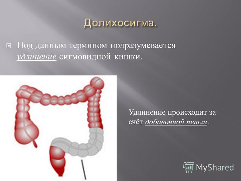 Диета При Длинной Сигмовидной Кишки