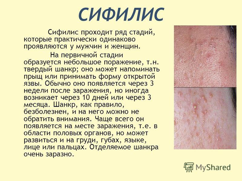 фото зппп у мужчин онлайн фото зппп у мужчин