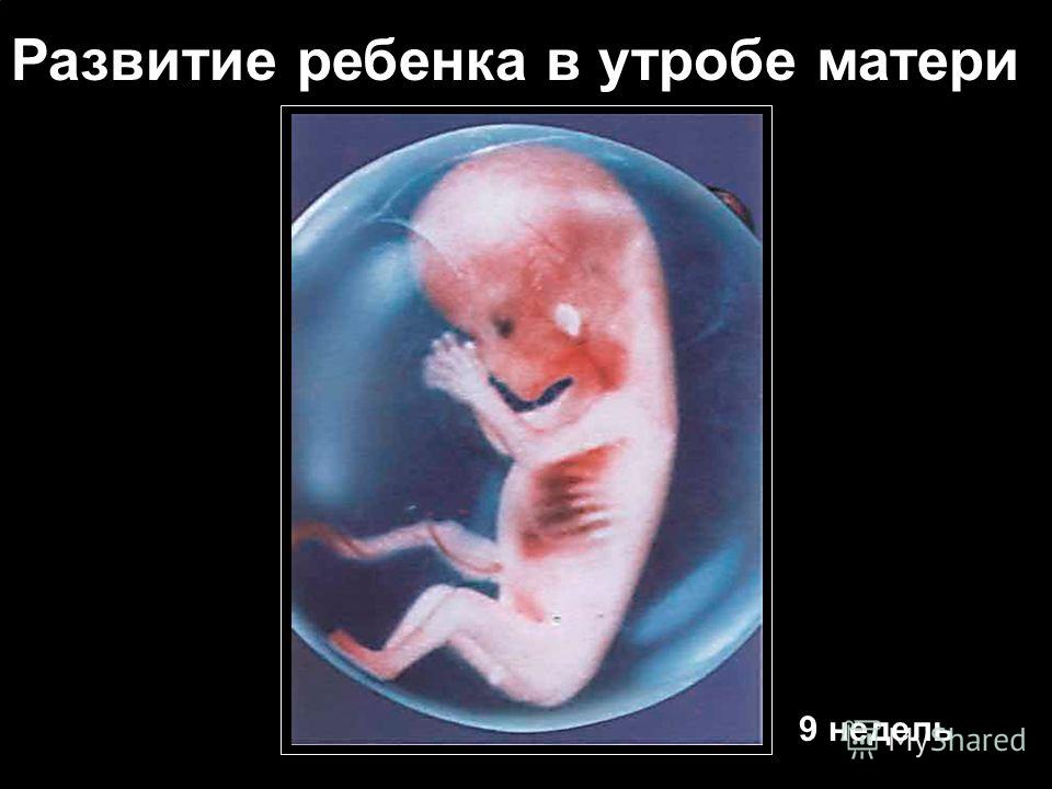 Как Выглядит Ребенок 9 Недель Фото Как Выглядит Ребенок 9 Недель Фото