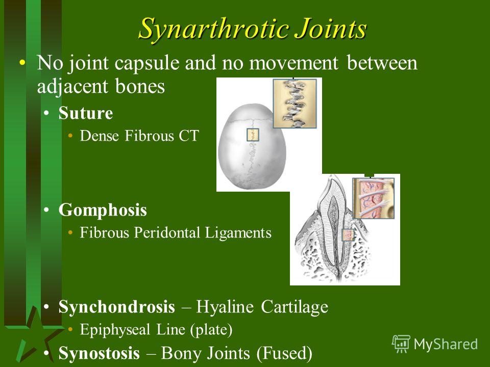 synarthrotic fibrous joint between the bones of the skull are called