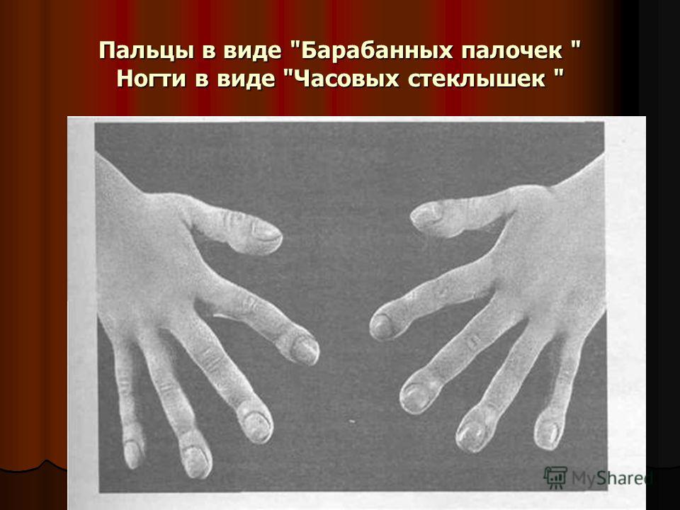 Пальцы и ногти как барабанные палочки Пальцы и ногти как барабанные палочки