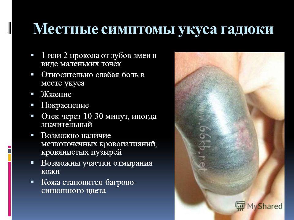 укусы гадюки фото