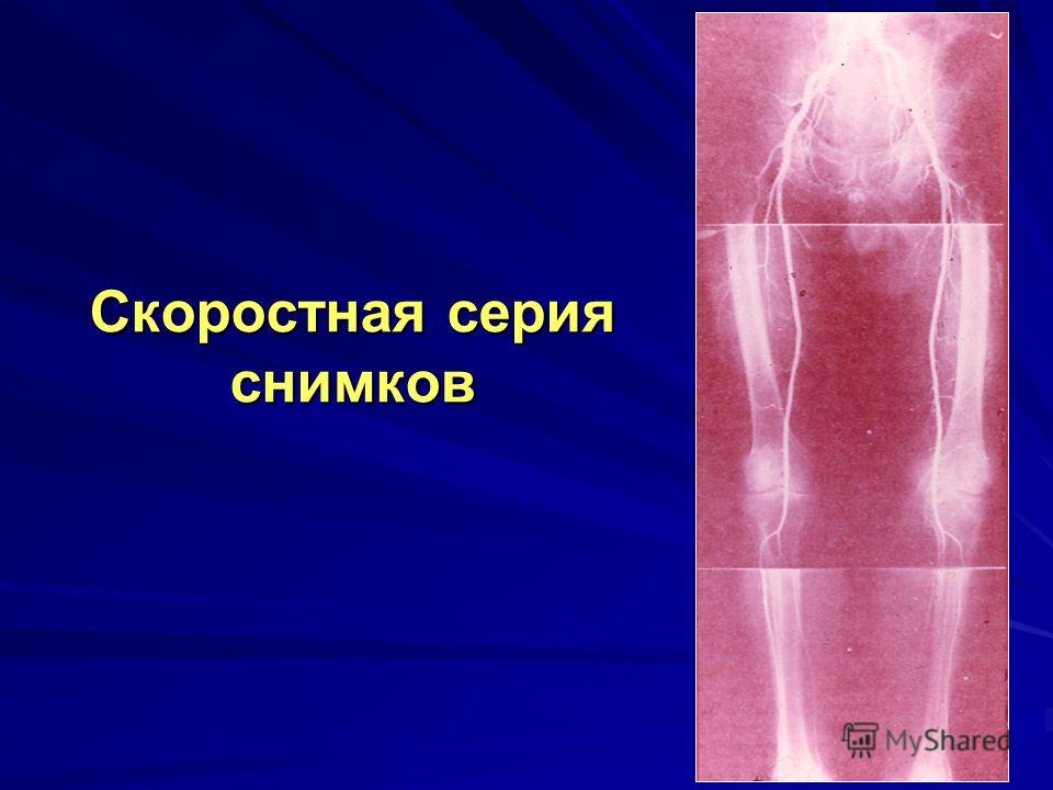 Боли в пояснично тазобедренном суставе