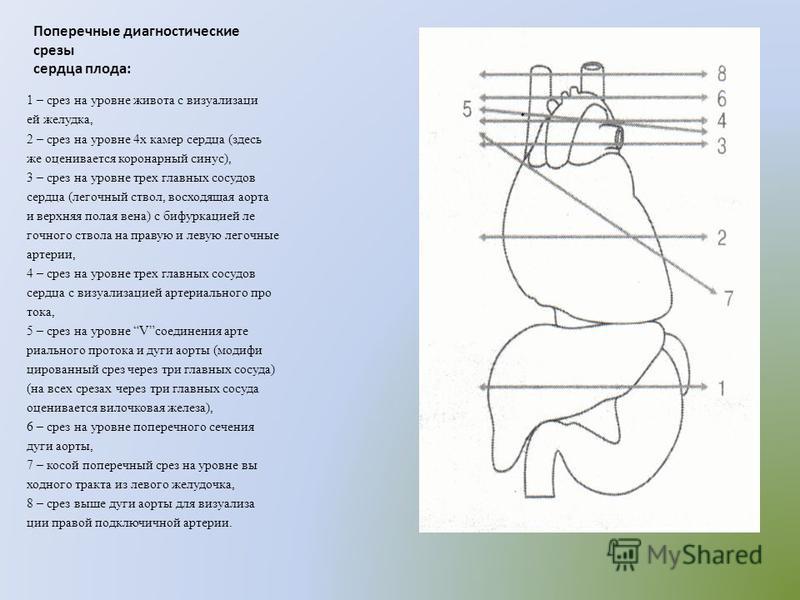Как бинтовать ногу при варикозе