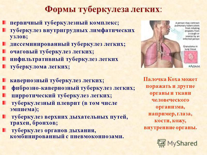 Туберкулез легких и язвенная болезнь как лечить Туберкулез легких и язвенная болезнь как лечить