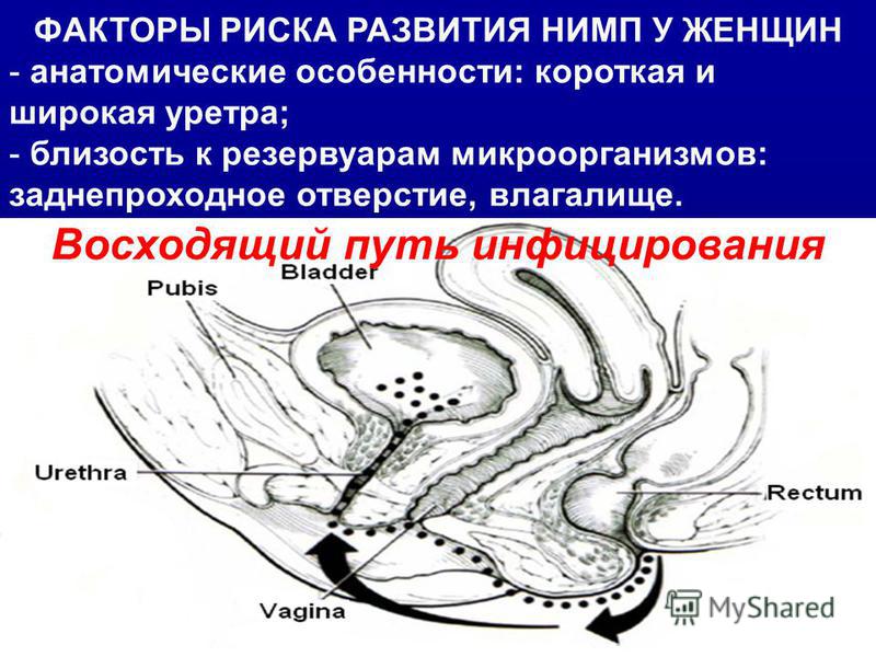 Фосфомицин в лечении острого неосложненного цистита мифы и факты