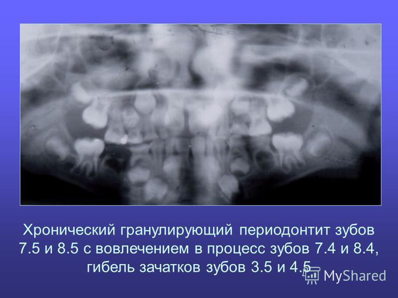 День рождения для вашего ребенка / Праздник дома. Сценарии Глиттер: что это такое и как его использовать в макияже