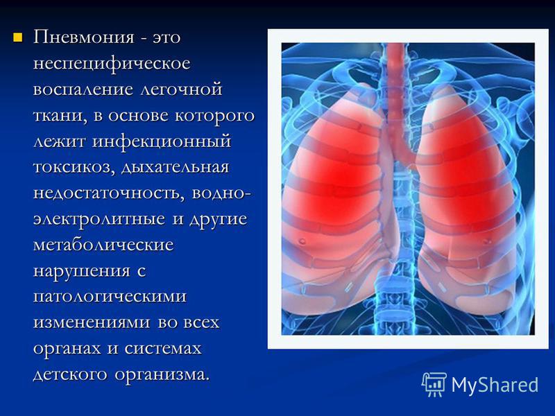 Реферат: Пневмонии