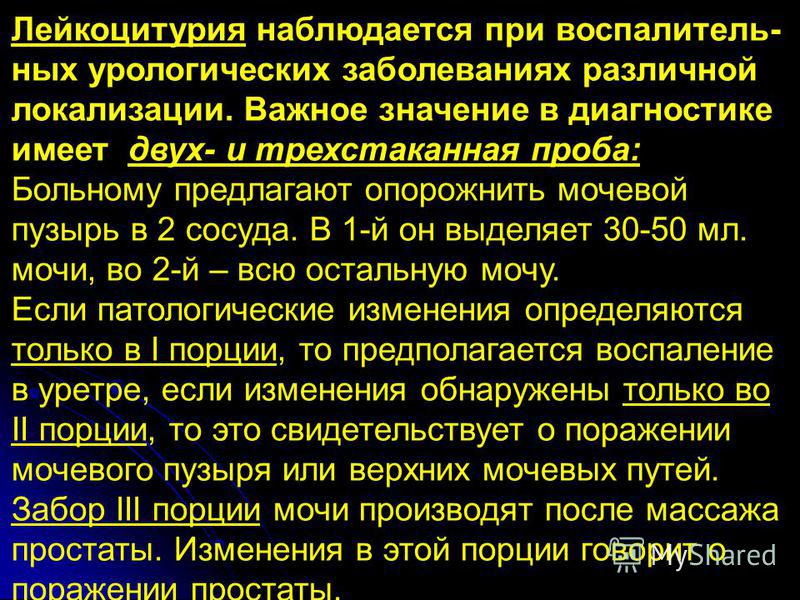 Что необходимо перед узи предстательной железы