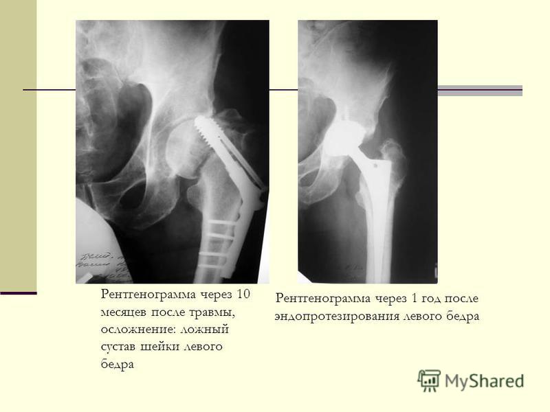 Педикюрные носочки справятся с болезненными мозолями и трещинами Педикюрные носочки справятся с болезненными мозолями и трещинами