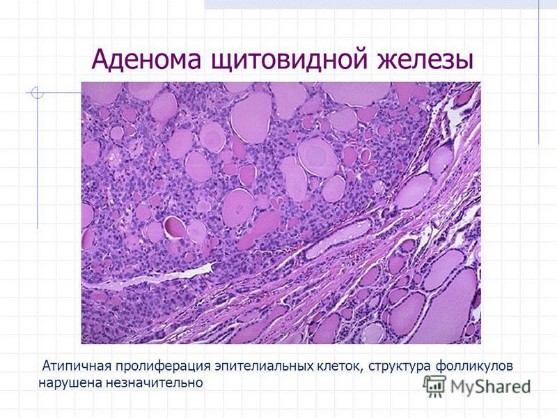 Йогатерапия позвоночника упражнения йога-терапии (фото) Значение тату на пояснице: смысл, история и фото готовых татуировок