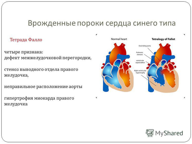 44 года топазовая свадьба поздравления прикольные 44 года топазовая свадьба поздравления прикольные