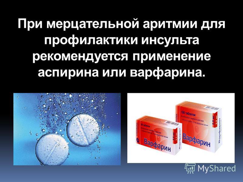Презентация на тему: "ЗАБОЛЕВАНИЯ, СОПРОВОЖДАЮЩИЕСЯ НАРУШЕНИЕМ РИТМА. АРИТМИИ СЕ