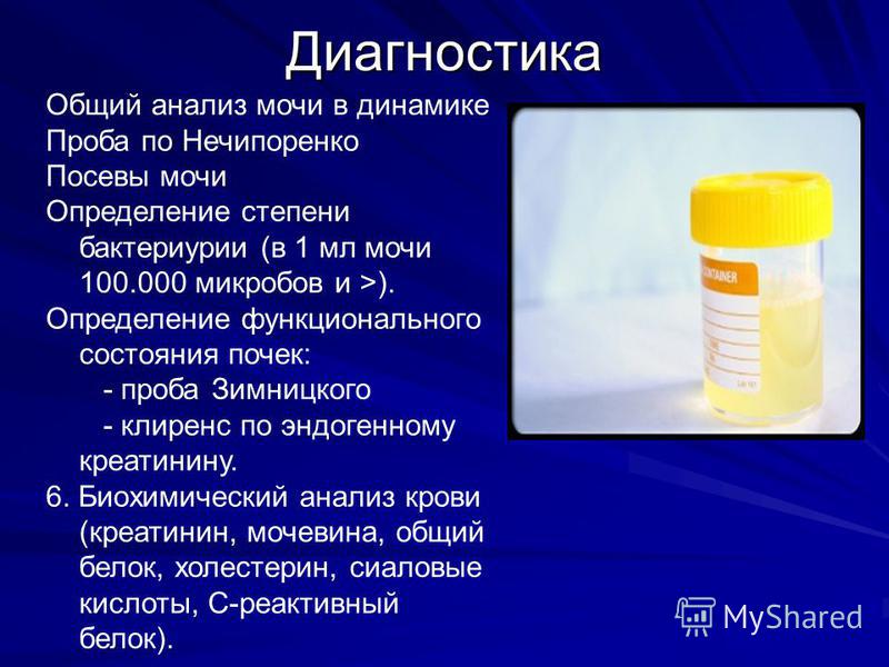 Как собрать анализ по нечипоренко у беременных 58
