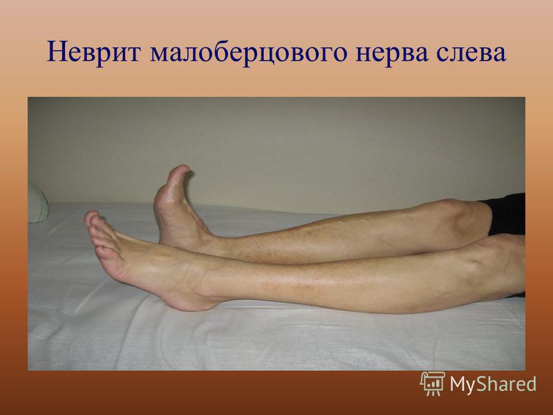 Как осенью сажать дельфиниум
