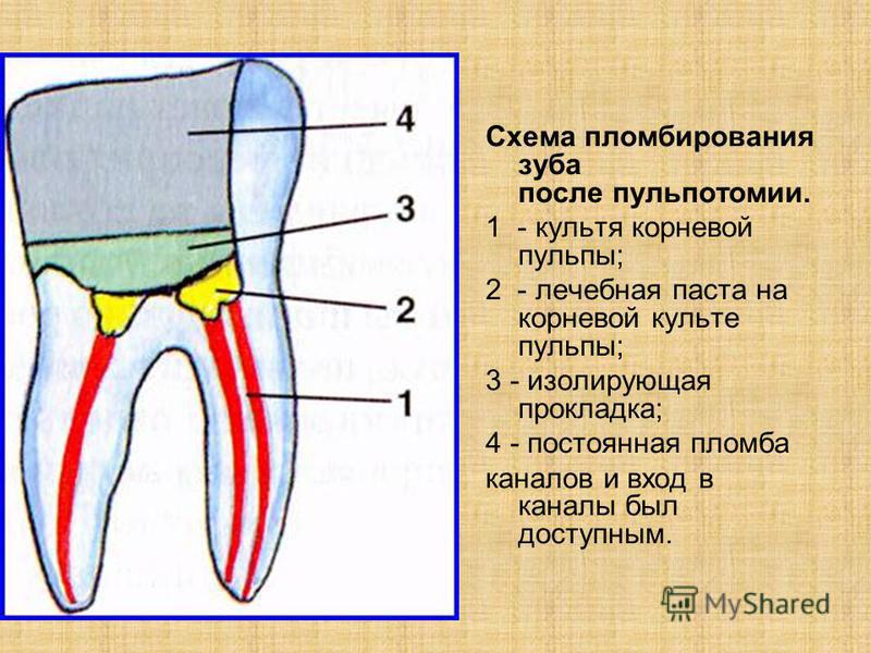 Шарики на корнях зубов Шарики на корнях зубов