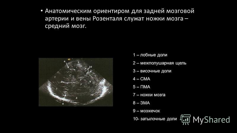 Презентация на тему узи