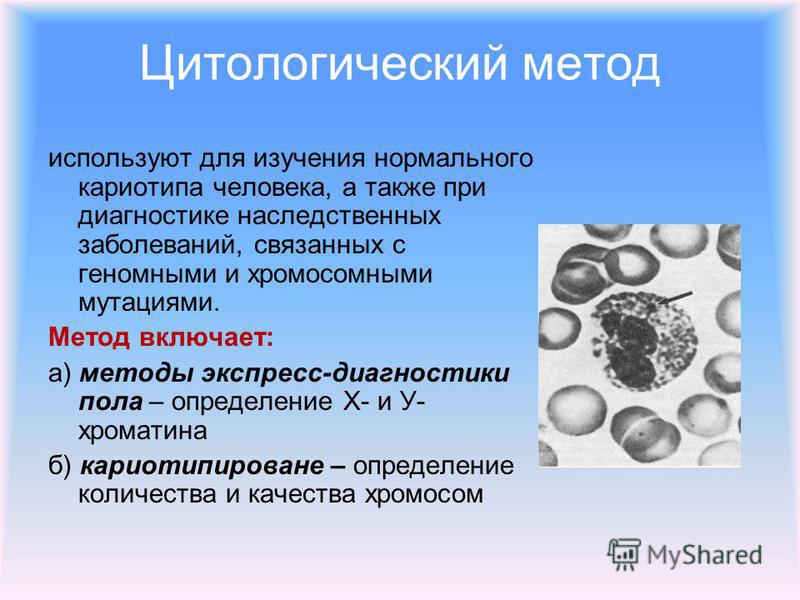 Как украсить шампанское. Мастер-класс Вместе Как сделать чокер на шею своими руками (50 фото)
