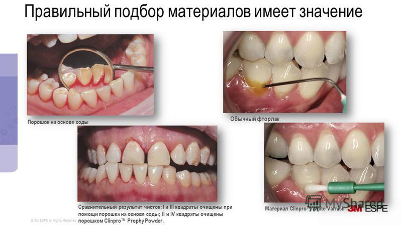 Плетение бисером цветы пошаговое фото для начинающих Плетение бисером цветы пошаговое фото для начинающих