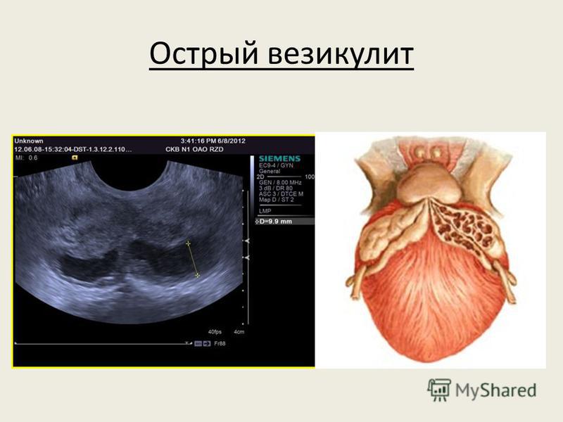 Медсестры делают массаж простаты онлайн