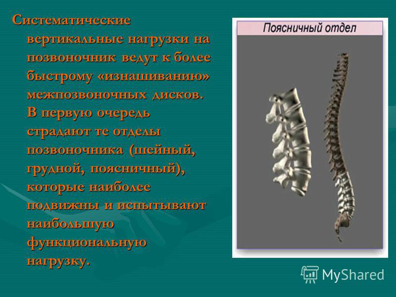Позвоночник влияние нагрузки на Позвоночник влияние нагрузки на