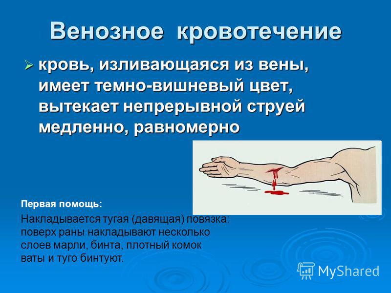 Почему надуваются вены на руках