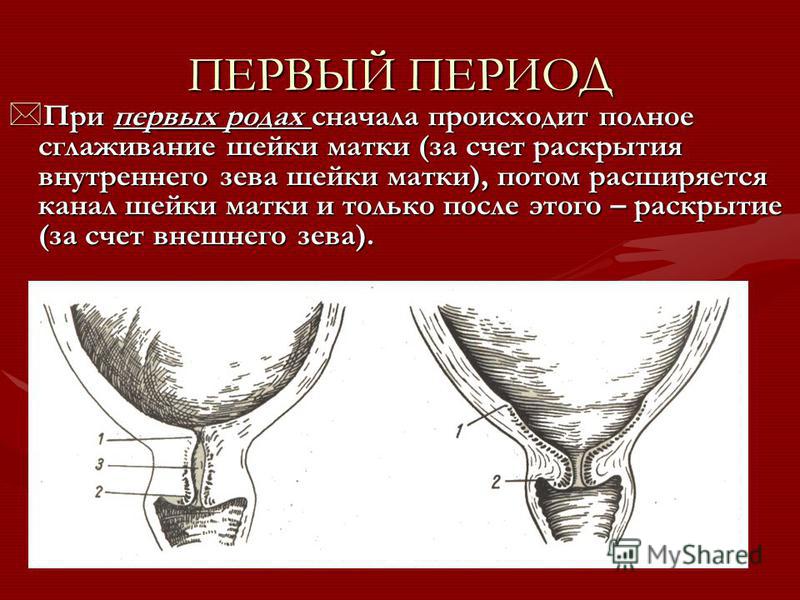 Упражнения для беременных для раскрытия шейки матки 599 Упражнения для беременных для раскрытия шейки матки 732