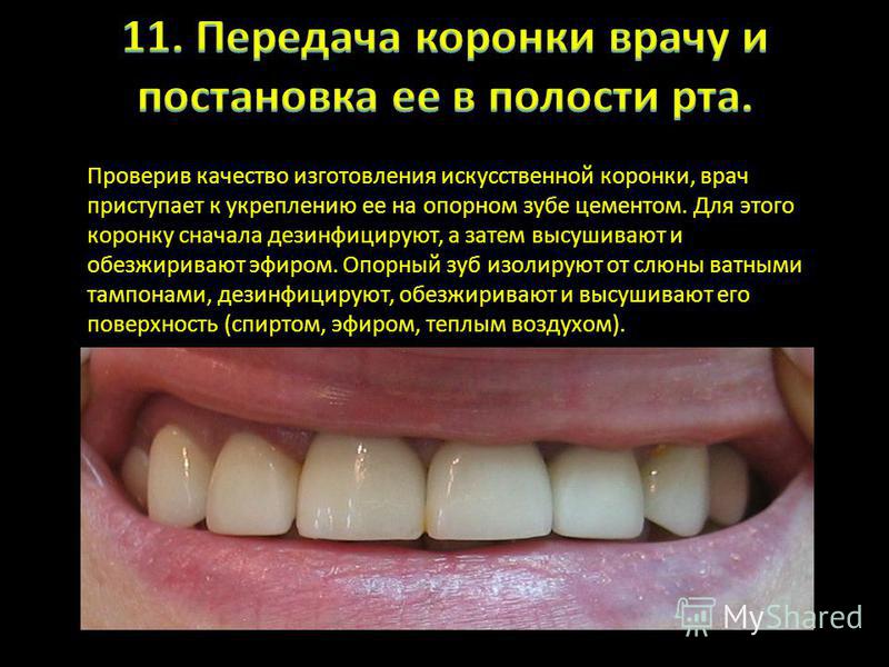 Цемент для металлокерамических зубов Цемент для металлокерамических зубов