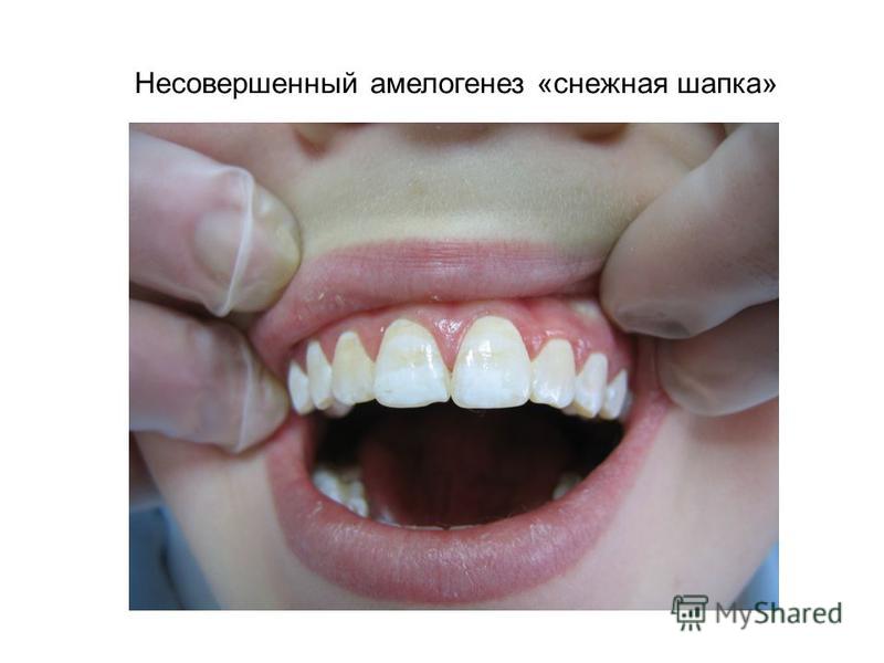 Прически на средние волосы: фото, видео, мастер Почему женщины не ухаживают за собой Секреты