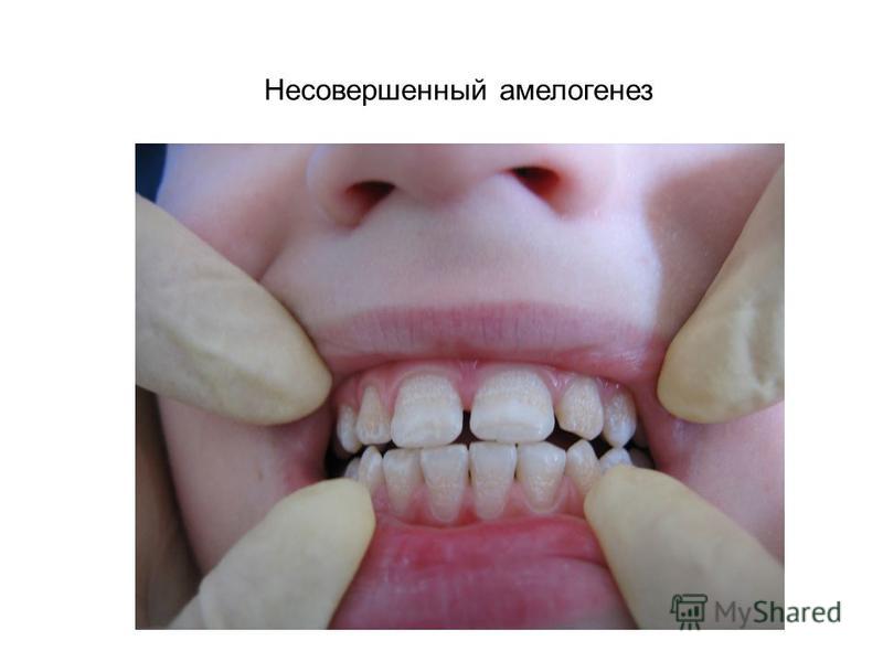 Можно ли мочить татуаж бровей Модные платья из Италии. Красивые, нарядные итальянские платья