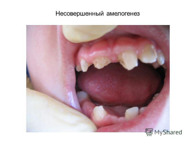 Новый круг понятий в сочинении 15.3 Наращивание ногтей гелем в Киеве недорого. - Салон «Акварель