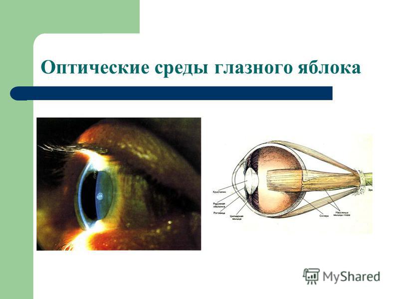 Оптические среды глазного яблока