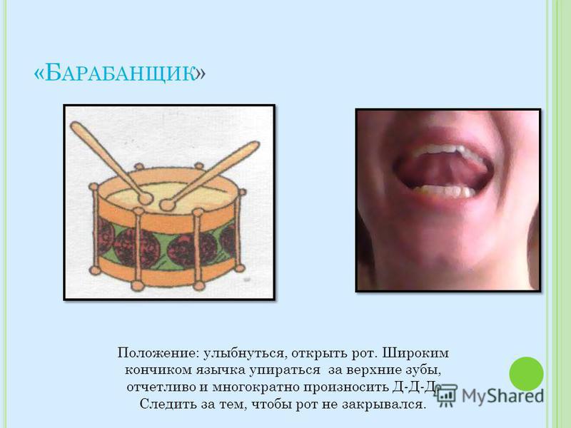 «Б АРАБАНЩИК » Положение: улыбнуться, открыть рот. Широким кончиком язычка упираться за верхние зубы, отчетливо и многократно произносить Д-Д-Д. Следить за тем, чтобы рот не закрывался.