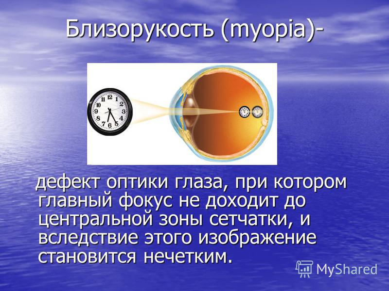 Близорукость (myopia)- дефект оптики глаза, при котором главный фокус не доходит до центральной зоны сетчатки, и вследствие этого изображение становится нечетким. дефект оптики глаза, при котором главный фокус не доходит до центральной зоны сетчатки,