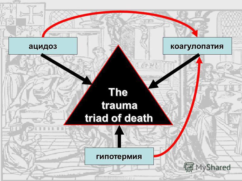 trauma triad of death trauma triad of death