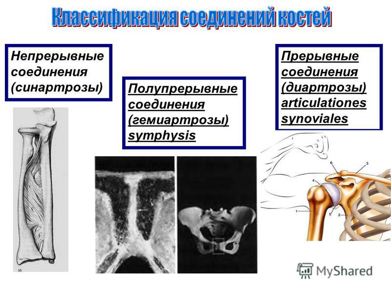 Непрерывные соединения (синартрозы) Полупрерывные соединения (гемиартрозы) symphysis Прерывные соединения (диартрозы) articulationes synoviales