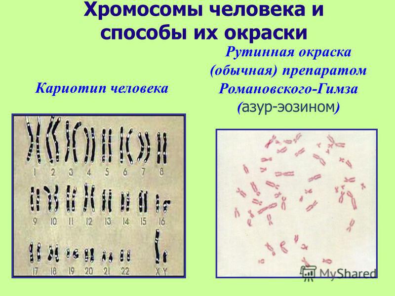 Хромосомы человека и способы их окраски Кариотип человека Рутинная окраска (обычная) препаратом Романовского-Гимза ( азур-эозином )
