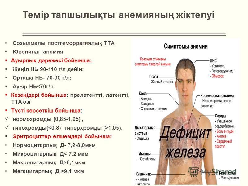 Как выглядят люди с анемией