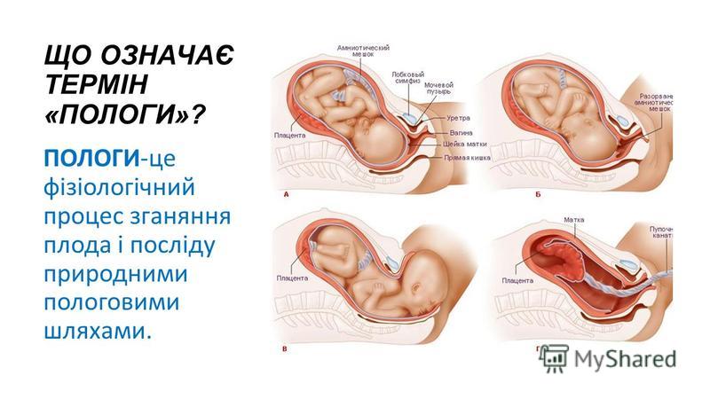 Реферат: Патологія вагітності і пологів