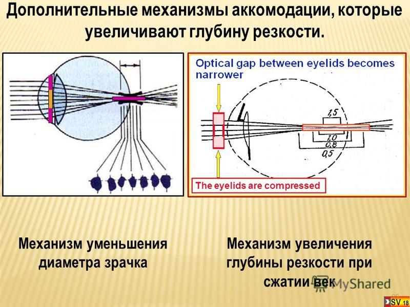 Механизм аккомодации презентация