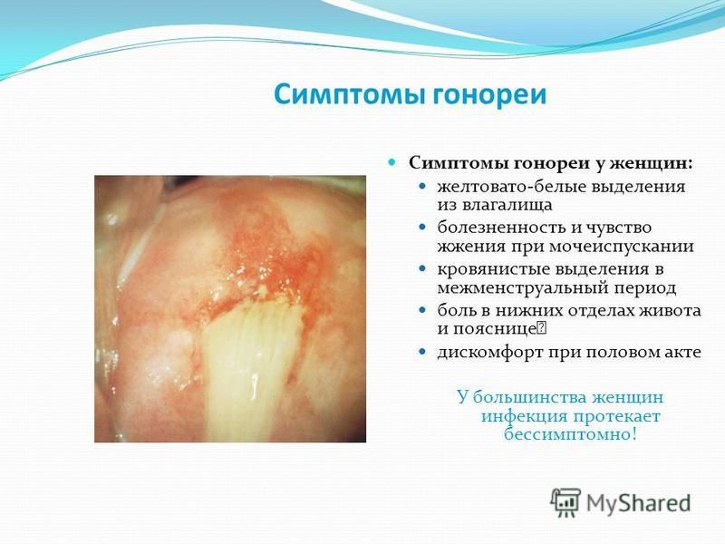 Болезненность шишки у большого пальца. Шишка на суставе пальца руки: причины и лечение, признаки уплотнений. Теносиновит де Кервена - KinesioPro Ушиб пальца - признаки, причины, симптомы, лечение и профилактика.